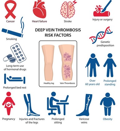 Deep Vein Thrombosis