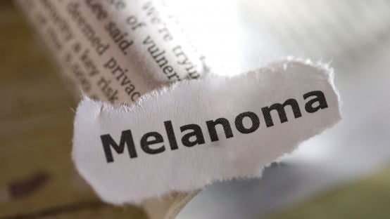 Melanoma research gets a boost